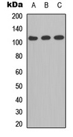 CD41 LC 1 Rabbit Polyclonal Antibody