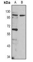 CD62P Antibody
