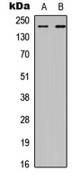 CHD2 Antibody