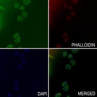 Anti-Collagen 15 alpha 1 Antibody