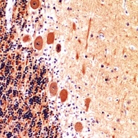 Collagen V alpha 2 antibody