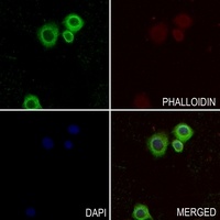 Collagen V alpha 2 antibody