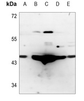 CTH Antibody