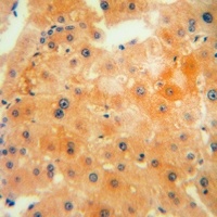 Anti-CTH Antibody