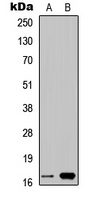 Cystatin 9L1 Antibody