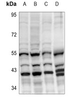 Cytochrome P450 27C1 Rabbit Polyclonal Antibody