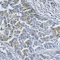 Anti-DnaJC3 Antibody