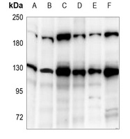 DNMT3A Antibody