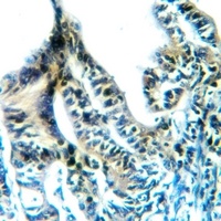 Anti-DNMT3A Antibody