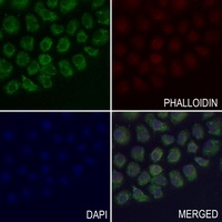 Anti-EB2 Antibody