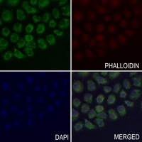 EB2 antibody