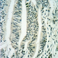 EIF2S2 (phospho-S67) antibody