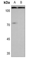 Enterokinase LC Antibody