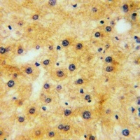 Anti-EPHA1 (Phospho-Y605) Antibody