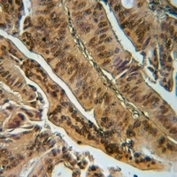 Anti-EYA1 Antibody