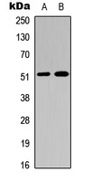 Factor IX HC Antibody