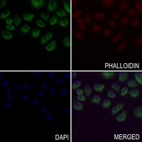 Factor IX LC Antibody