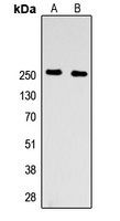 Factor V HC Rabbit Polyclonal Antibody