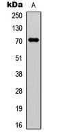 Factor XI HC Antibody
