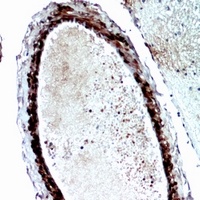 Anti-FGF17 Antibody