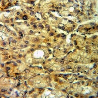 Anti-FGF4 Antibody