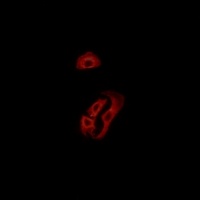Anti-FPR3 Antibody