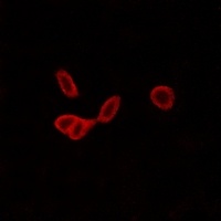 GALR1 antibody