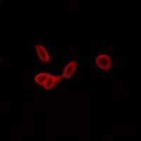 Anti-GALR1 Antibody