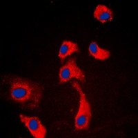 Anti-GPR116 Antibody
