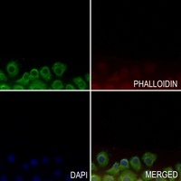 Anti-GPR143 Antibody