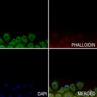 GPR143 antibody