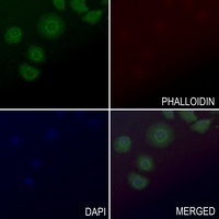 Anti-GPR54 Antibody