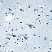 Anti-GPR85 Antibody