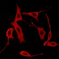 Anti-GPR85 Antibody
