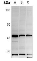 HLA-A/B/C Rabbit Polyclonal Antibody