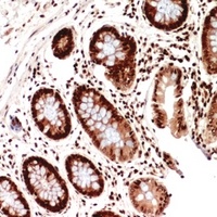Anti-HLA-DQB1 Antibody