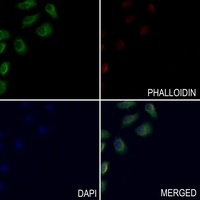 Anti-HLA-DQB1 Antibody
