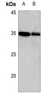 HOXC8 Rabbit Polyclonal Antibody