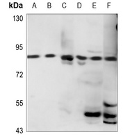 HSD17B4 Antibody