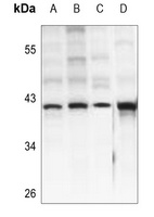 IDH3 beta Rabbit Polyclonal Antibody