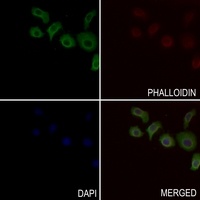 IDH3 beta Rabbit Polyclonal Antibody