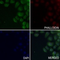 Anti-IL-20RA Antibody
