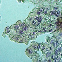 Anti-IMMP1L Antibody