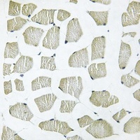 ITIH4 70k Antibody