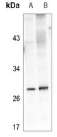 Kallikrein 4 Rabbit Polyclonal Antibody