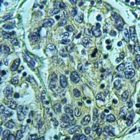 Anti-KCNE1L Antibody