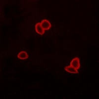 Anti-LPHN1 Antibody