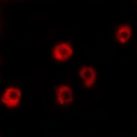 Anti-LPHN2 Antibody