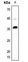 MASP1 LC Antibody