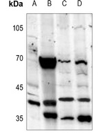 Melatonin Receptor 1a Antibody
